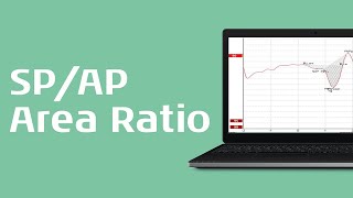 Using the SPAP Area Ratio for Diagnosis of Menieres Disease [upl. by Elocen972]