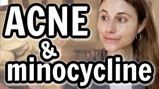 Minocycline versus doxycycline for acne Dr Dray [upl. by Akiehs]