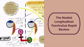 Medial Longitudinal Fasciculus Rapid Review [upl. by Etneciv]