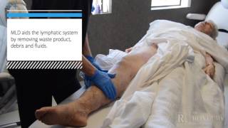 Manual Lymphatic Drainage MLD PostLipedema Surgery [upl. by Tiga]