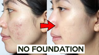 How to Cover Acne amp Blemishes WITHOUT Foundation • easy amp non cakey [upl. by Nybor]