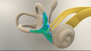 Menieres Disease  What Happens in the Inner Ear [upl. by Novek633]